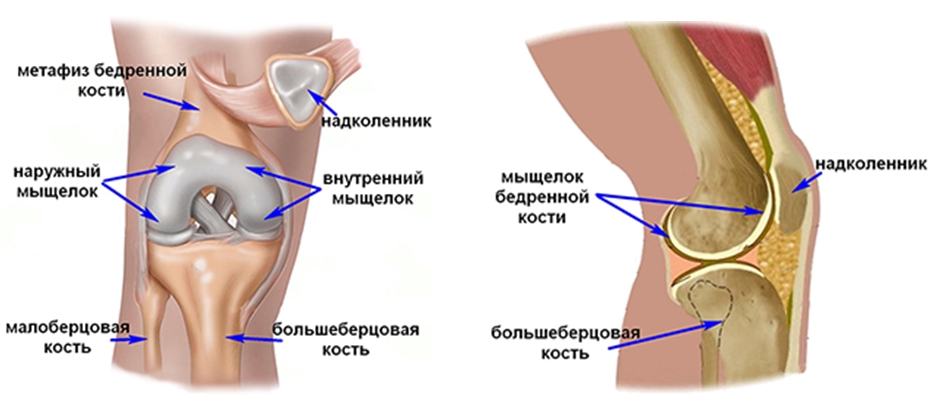 Перелом дистальной части бедренной кости