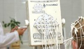 Определение ирритативных изменений на ЭЭГ в Юсуповской больнице