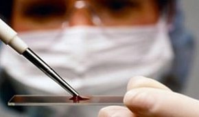 Методы диагностики онкологических заболеваний