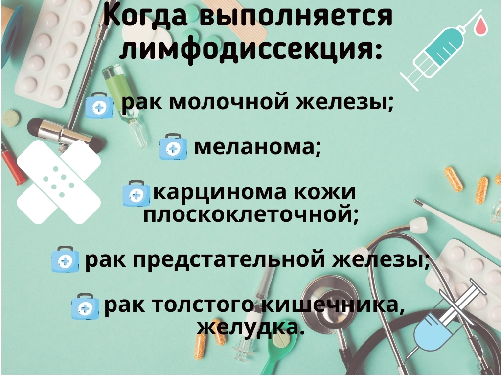 когда проводится лимфодиссекция