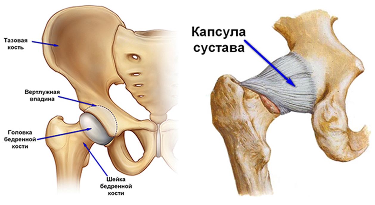 перелом шейки бедренной кости